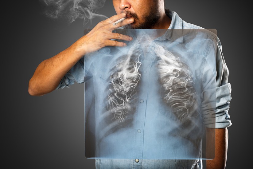 Smoking related lung disease to cost the NHS £2.3billion by 2030! -  Vapour.com - Electronic Cigarettes, E-Cigs, and E-Liquids for Vaping